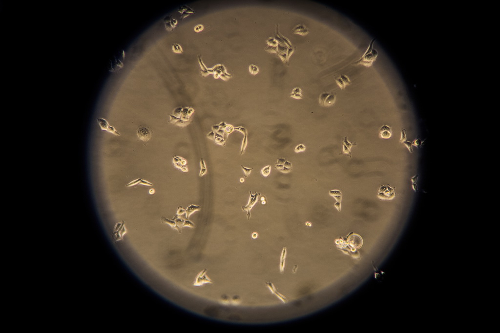 Крупную партию соленой медузы, зараженной бактериями, выявили в Приморье